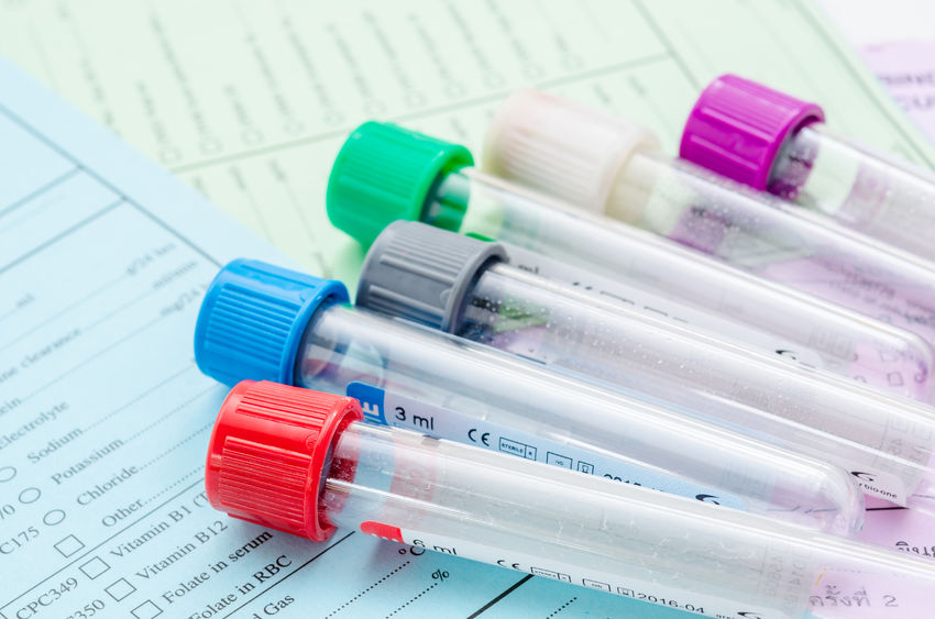 Fasting Blood Sugar